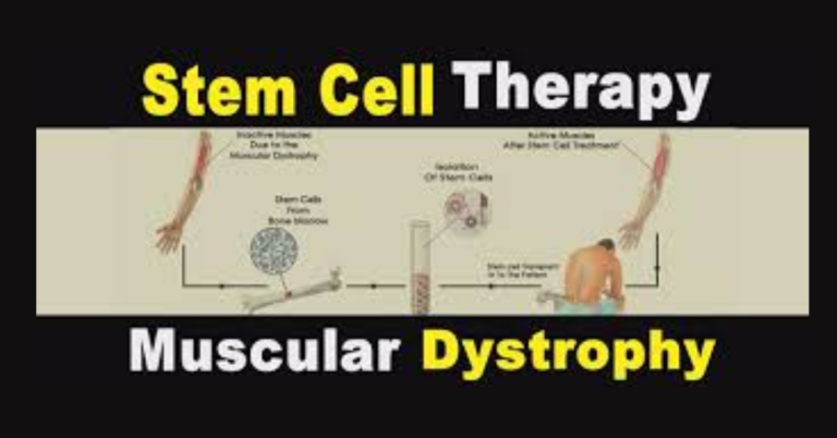 Muscular Dystrophy Stem Cell Therapy in India: A Ray of Hope