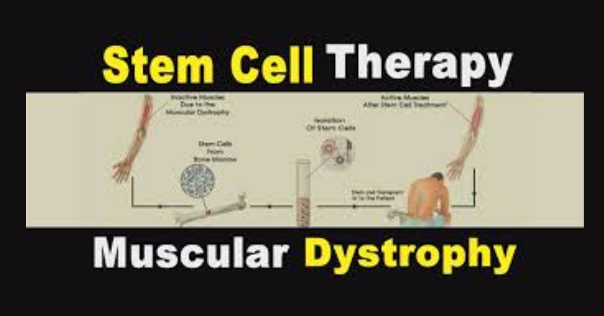 Muscular Dystrophy Stem Cell Therapy India